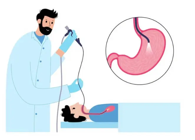 Gastroscopy: What to Expect from Your Upper Endoscopy Procedure