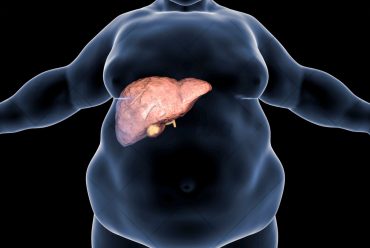 Navigating Non-Alcoholic Fatty Liver Disease (NAFLD): Causes, Symptoms, and Management Strategies.