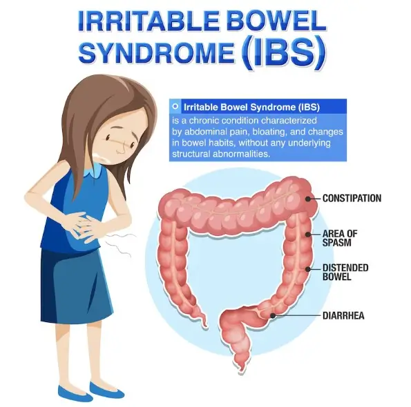 Post-Infectious IBS: Understanding How Infections Can Lead to Long-Term Digestive Issues