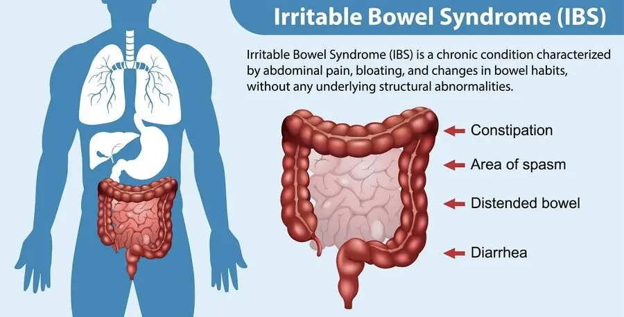 IBS-Causes-Symptoms-Solution