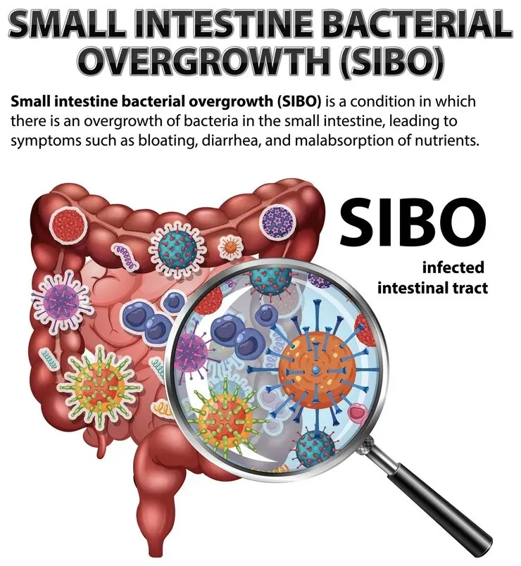 SIBO-Symptoms-Causes-Solution