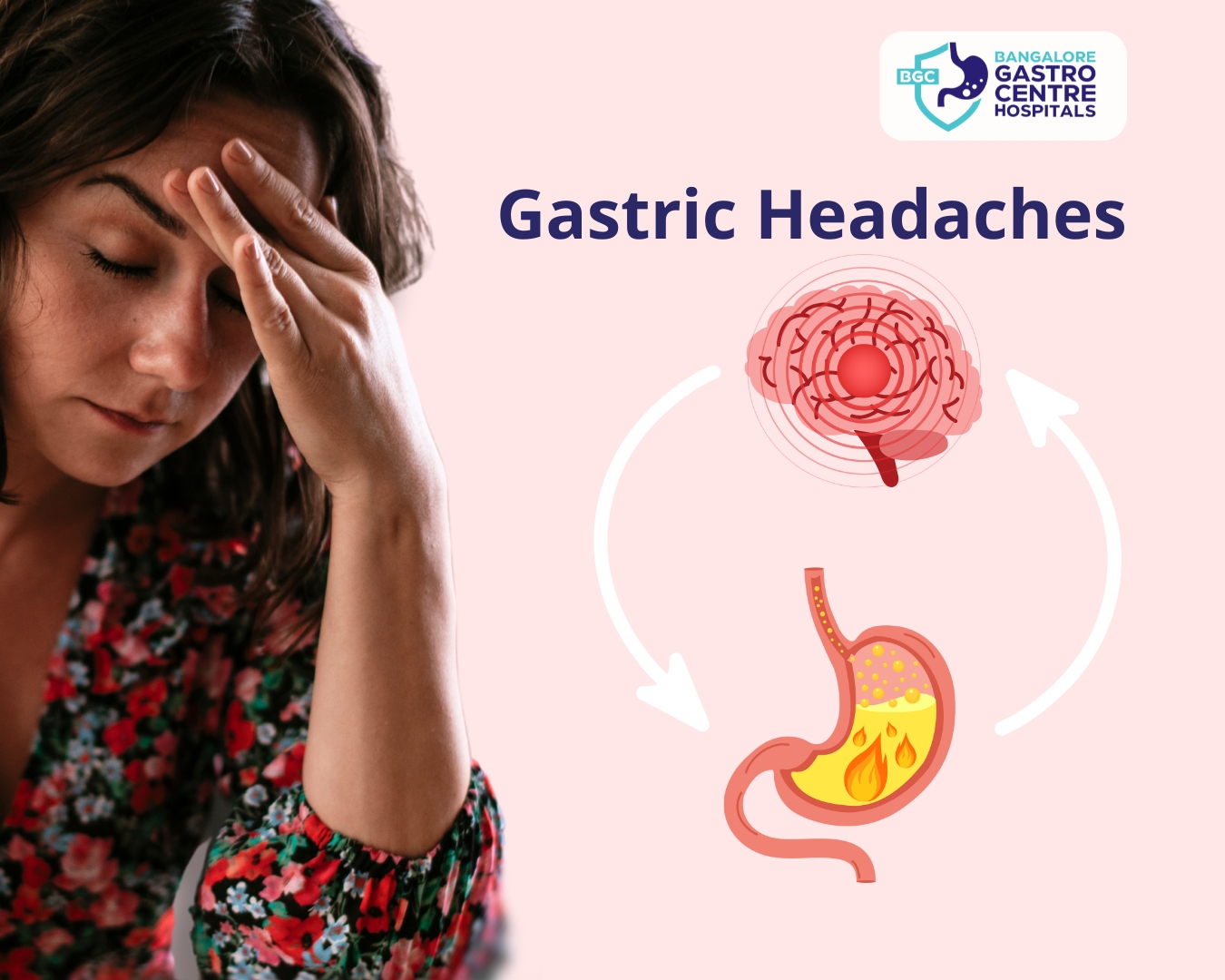 Understanding Gastric Headaches: Illustration showing the link between acid reflux, digestive issues, and headaches. Solutions for managing gastric headaches with Bangalore Gastro Centre Hospitals.