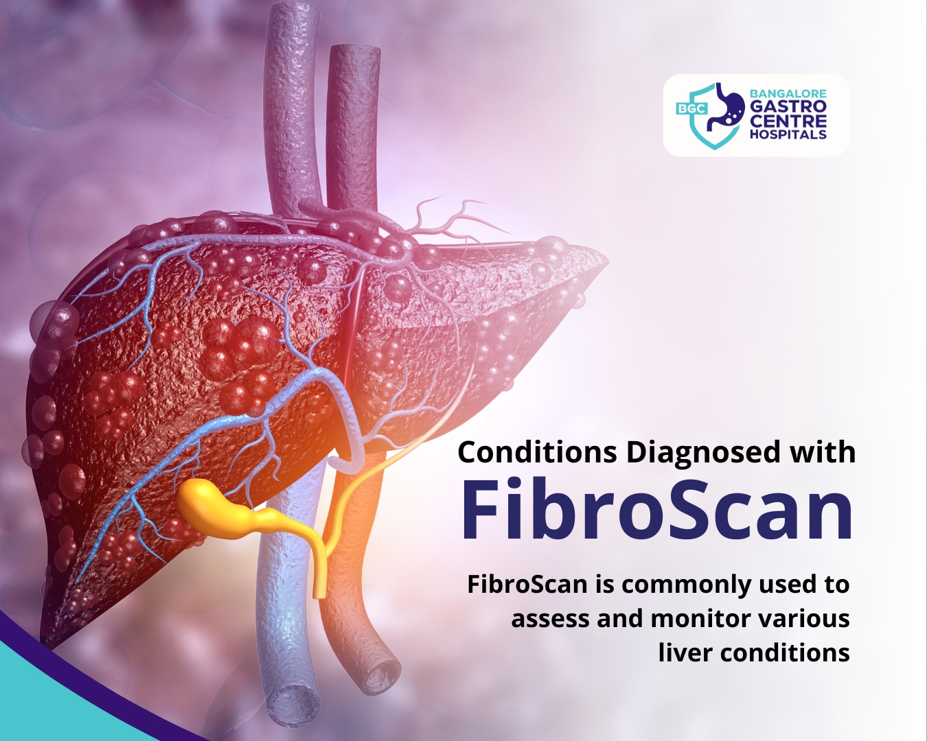FibroScan machine for non-invasive liver scan at Bangalore Gastro Centre