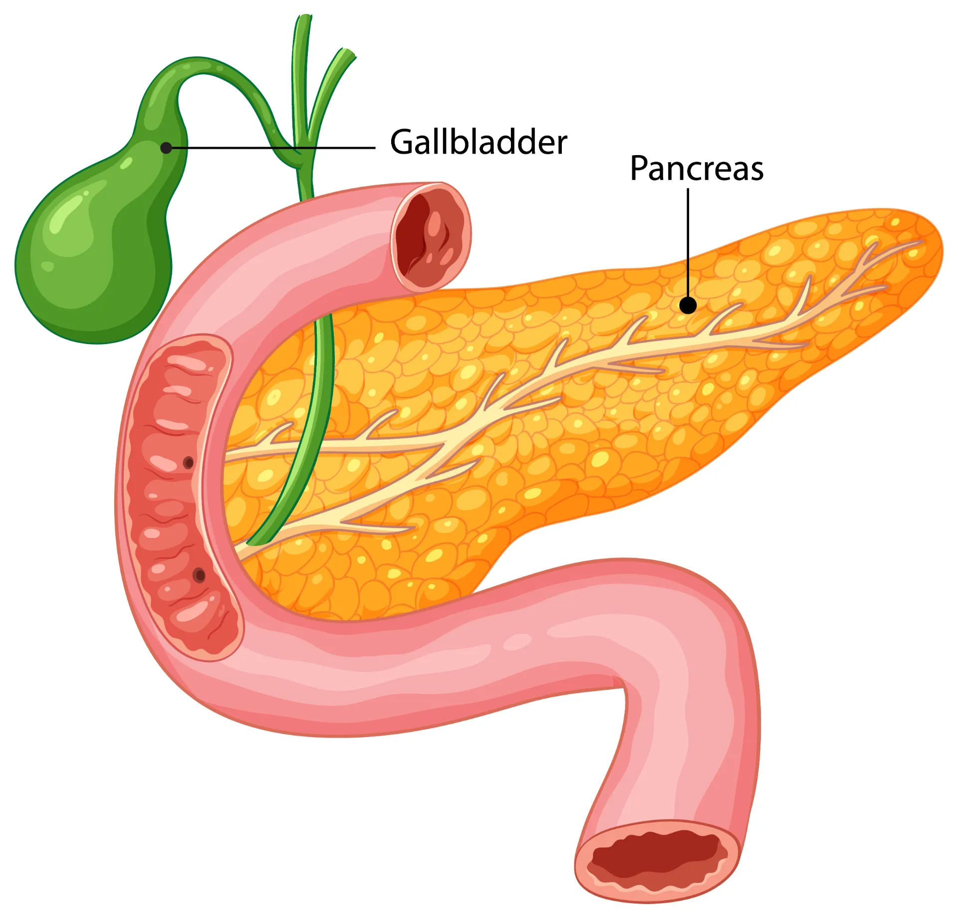 Pancreatic Enzyme Deficiency