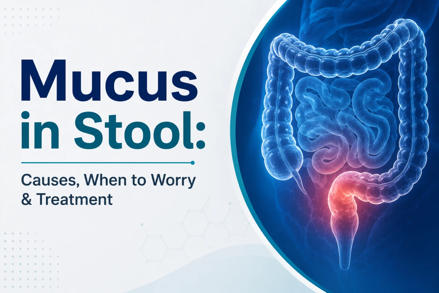 Mucus in Stool: Causes, When to Worry & Expert Treatments